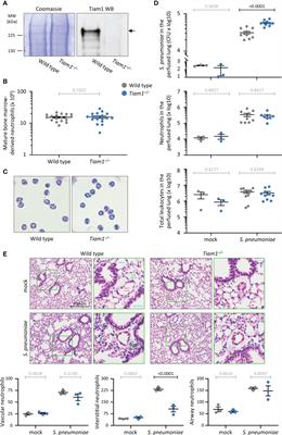 The Rac-GEF Tiam1 controls integrin-dependent neutrophil responses